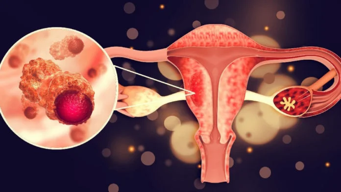 Pasos clave tras detectar VPH: hoja de ruta para proteger la salud femenina Importante según el criterio de Google Haz clic para indicar a Gmail que esta conversación no es importante