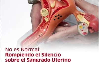 Sangrado uterino anormal afecta al 30% de las mujeres