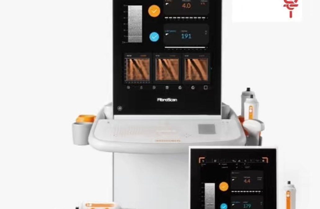 SAV incorpora tecnología FibroScan para detectar a tiempo riesgo de cirrosis y cáncer hepático