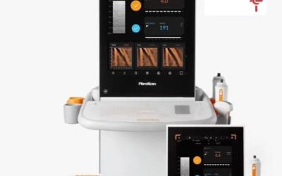 SAV incorpora tecnología FibroScan para detectar a tiempo riesgo de cirrosis y cáncer hepático
